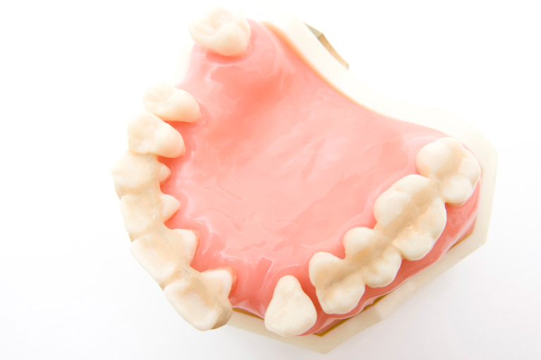 歯周病は「生活習慣病」です