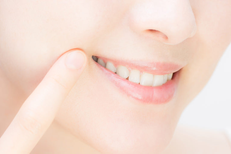 審美治療・ホワイトニング